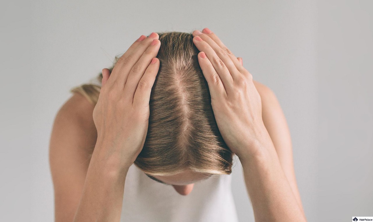 Hair Transplant London: Why Experience Matters in Hair Restoration